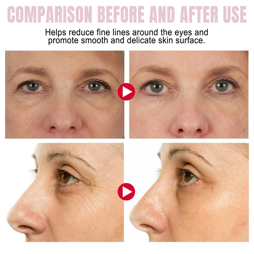 Retinol Eye Cream Stick Collagen Fade Fine Lines Wrinkle Lightening Dark Circles Firming Eye Bags Puffiness Moisturizing Eye Cre