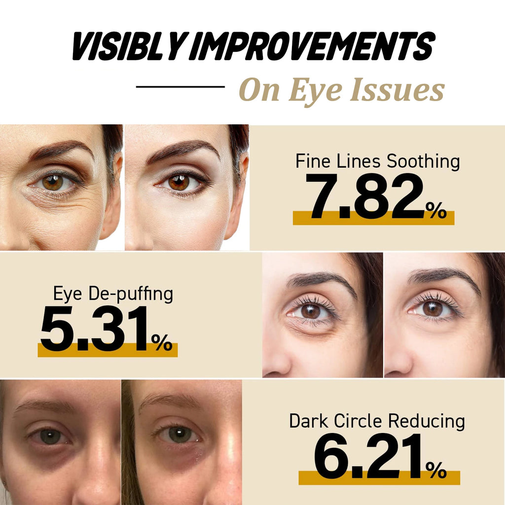Snail Mucin Eye Cream Stick W-rinkle Removing Lightening Dark Circle Remove Eye Bag Anti-Puffiness Firming Fade Fine Lines