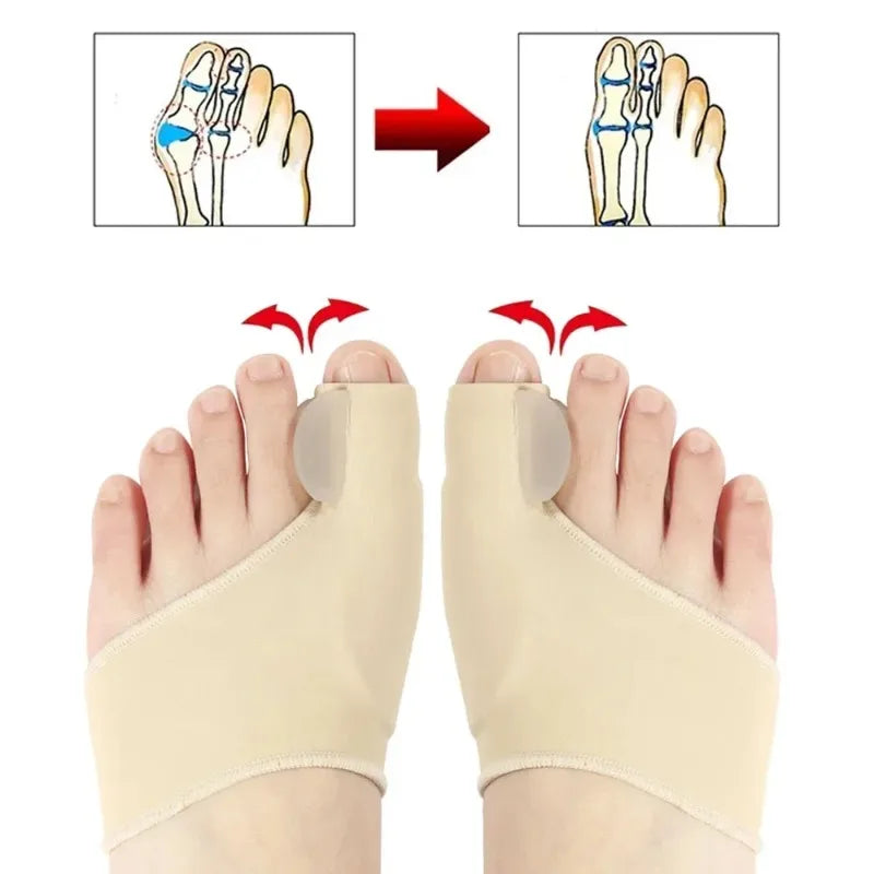 Hallux valgus orthosis shoe-wearing big toe phalanx protrusion toe separation correction magical device separated foot protector