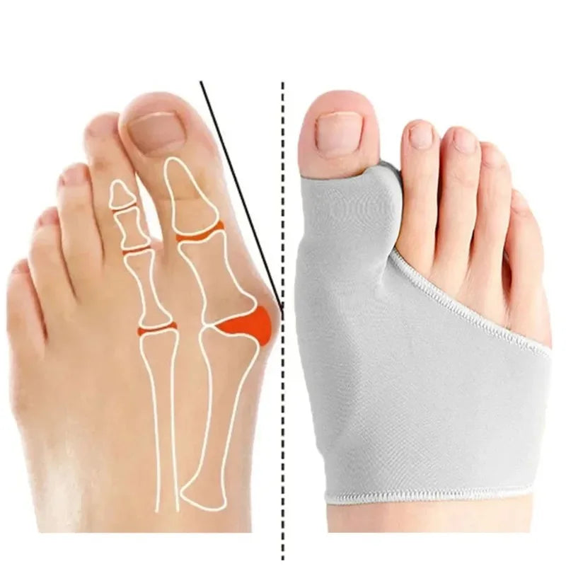 Hallux valgus orthosis shoe-wearing big toe phalanx protrusion toe separation correction magical device separated foot protector
